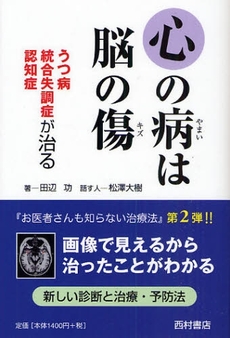 良書網 心の病は脳の傷 出版社: 西村書店 Code/ISBN: 9784890136308