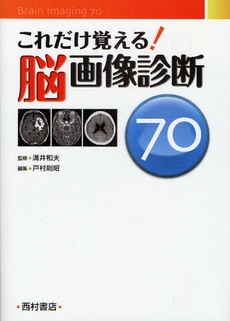 良書網 これだけ覚える!脳画像診断70 出版社: 西村書店 Code/ISBN: 978-4-89013-380-2
